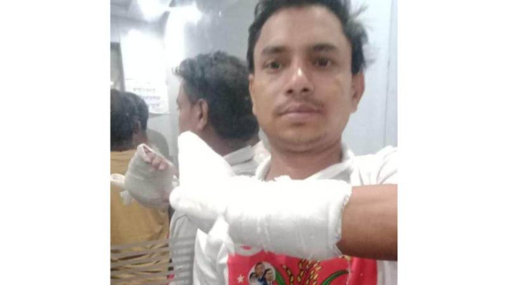 রূপগঞ্জে যুবদল নেতার হাত ভেঙে দিল যুবলীগ রূপগঞ্জে যুবদল নেতার হাত ভেঙে দিল যুবলীগ
