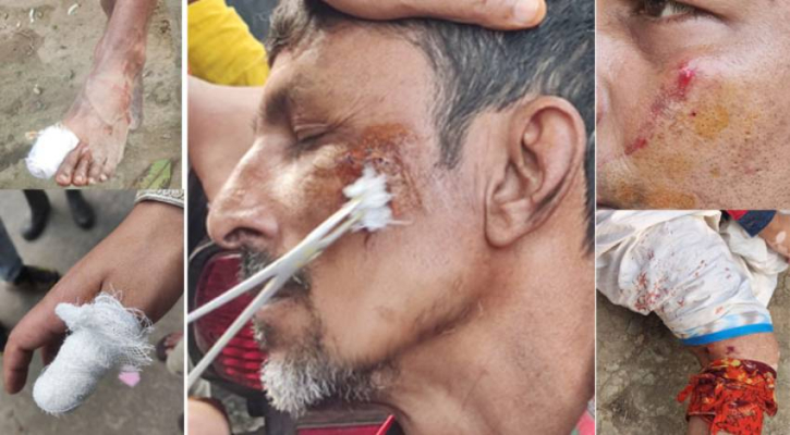 আবারো রফিক বাহিনীর তাণ্ডবে রক্তাক্ত নাওড়া আবারো রফিক বাহিনীর তাণ্ডবে রক্তাক্ত নাওড়া