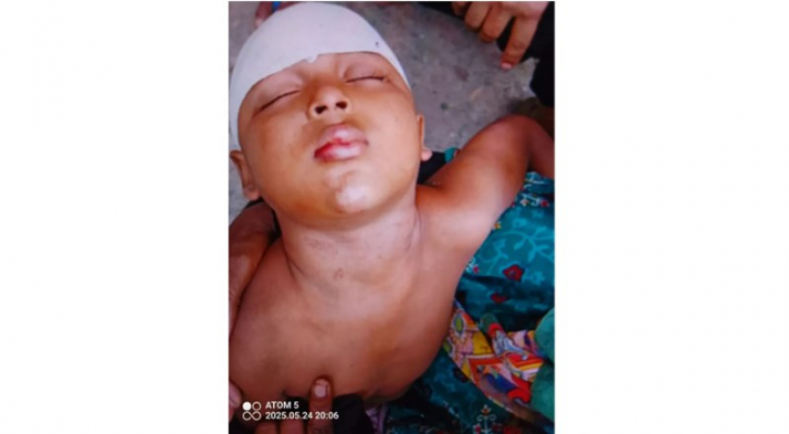 রূপগঞ্জে পূর্ব শত্রুতায় শিশুকে কুপিয়ে জখম রূপগঞ্জে পূর্ব শত্রুতায় শিশুকে কুপিয়ে জখম