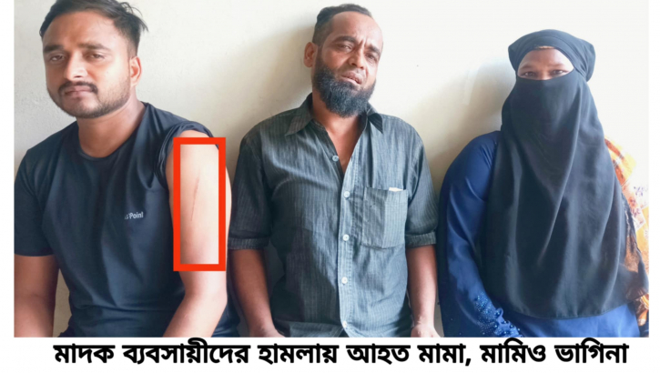বন্দরে মাদক ব্যবসায় বাধা দেওযার জের স্বামী স্ত্রীসহ আহত ৩ বন্দরে মাদক ব্যবসায় বাধা দেওযার জের স্বামী স্ত্রীসহ আহত ৩