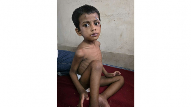 ফতুল্লায় নির্যাতনের শিকার শিশুকে তালা ভেঙ্গে উদ্ধার
