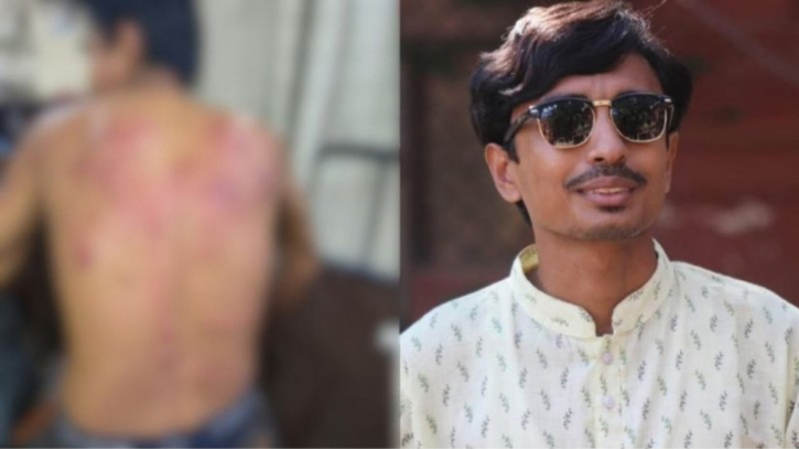 দুর্বৃত্তদের হামলায় আহত নজরুল কলেজ ছাত্র অধিকার পরিষদ নেতা নাহিদ দুর্বৃত্তদের হামলায় আহত নজরুল কলেজ ছাত্র অধিকার পরিষদ নেতা নাহিদ