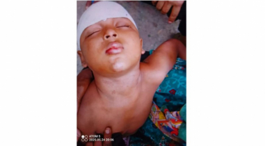 রূপগঞ্জে পূর্ব শত্রুতায় শিশুকে কুপিয়ে জখম