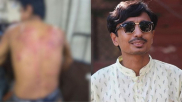 দুর্বৃত্তদের হামলায় আহত নজরুল কলেজ ছাত্র অধিকার পরিষদ নেতা নাহিদ