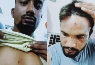 বন্দরে সিটিটোল আদায়কে কেন্দ্র করে হামলা. আহত-৫