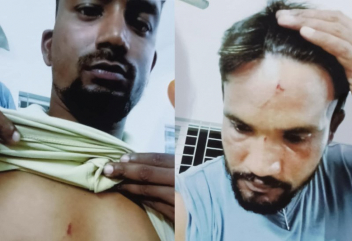 বন্দরে সিটিটোল আদায়কে কেন্দ্র করে হামলা. আহত-৫ বন্দরে সিটিটোল আদায়কে কেন্দ্র করে হামলা. আহত-৫