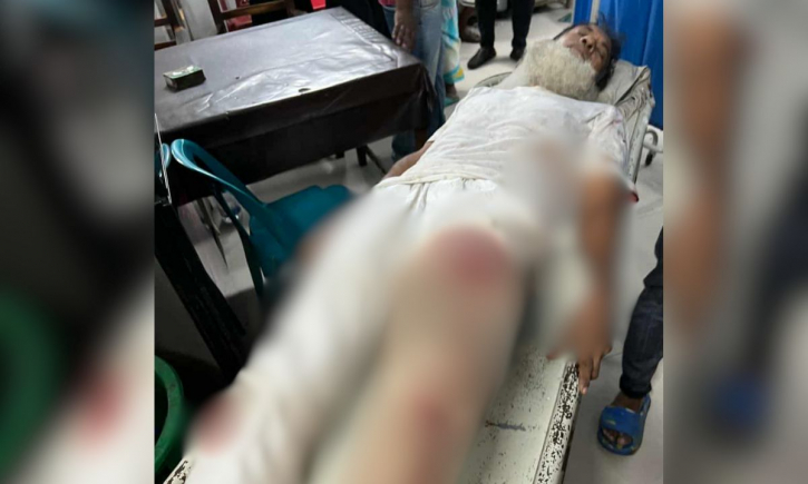 ছাত্রলীগ ও যুবদল নেতার গুলি-কোপে বৃদ্ধ আহত
