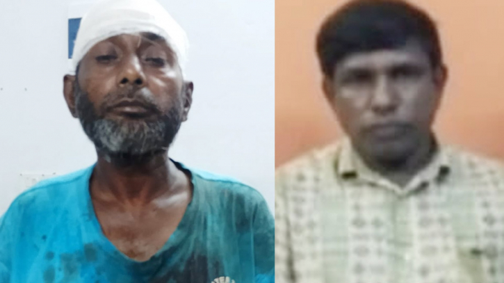 মেজ ভাইকে কুপিয়ে রক্তাক্ত ছোট ভাইয়ের বিরুদ্ধে মামলা